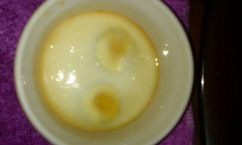 What Ingredients Make Poached Eggs Nutritious?