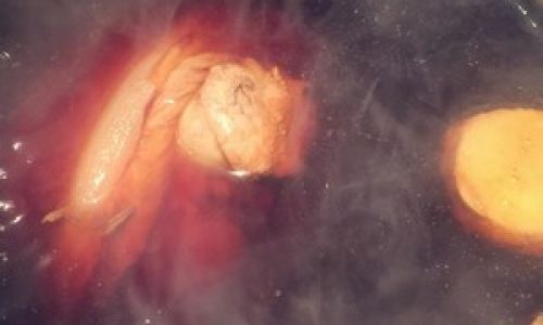 How to Make Steamed Pork Hock:A Culinary Journey