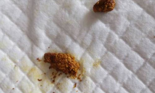 The Enigma of Insect Droppings Tea:Unraveling the Origins and Allure of 虫屎茶